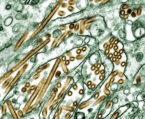 Magnified picture of Avian Influenza. bacteria
